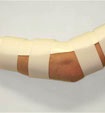 Cubital Tunnel Splint