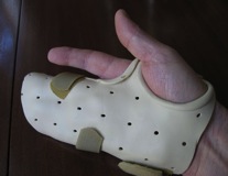 Static Extension Splint