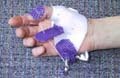 Static Progressive Thumb IPJ and MPJ Flexion Splint