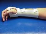 Wrist Cock Up Splint